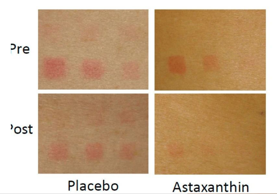 艾詩(shī)特蝦青素 艾詩(shī)特蝦青素