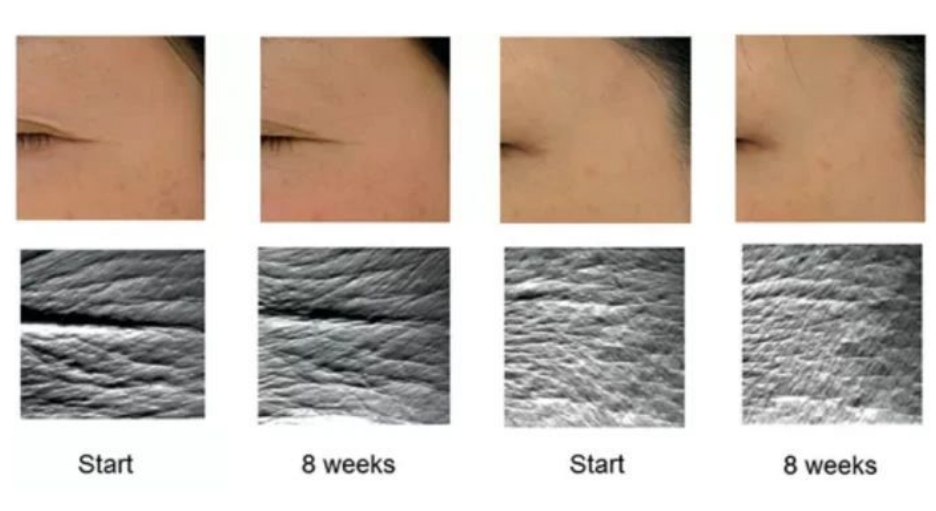 艾詩(shī)特蝦青素 艾詩(shī)特蝦青素