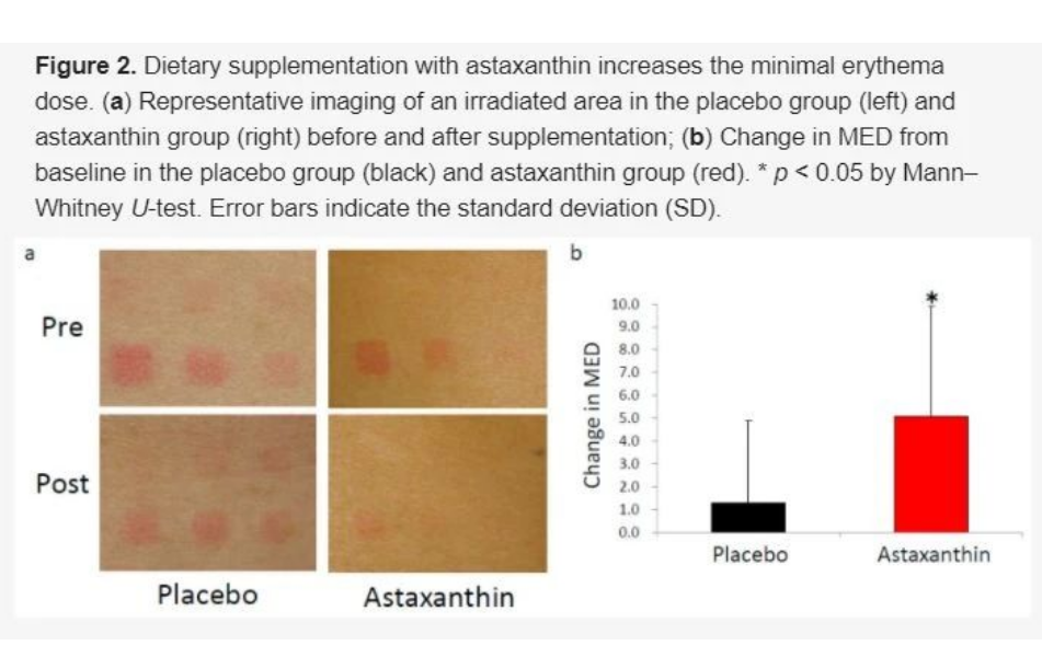 艾詩(shī)特蝦青素 艾詩(shī)特蝦青素