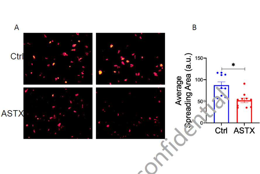 艾詩(shī)特蝦青素 艾詩(shī)特蝦青素