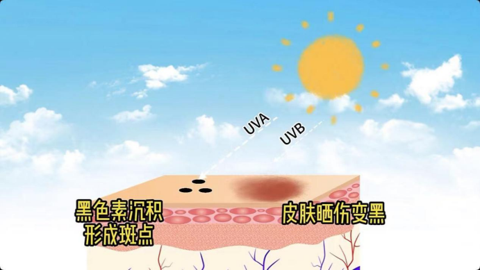 艾詩特蝦青素 艾詩特蝦青素