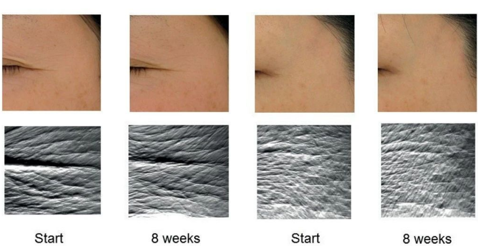 艾詩(shī)特蝦青素 艾詩(shī)特蝦青素