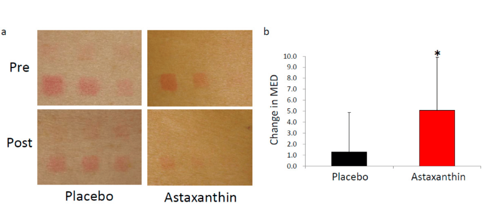 艾詩(shī)特蝦青素 艾詩(shī)特蝦青素