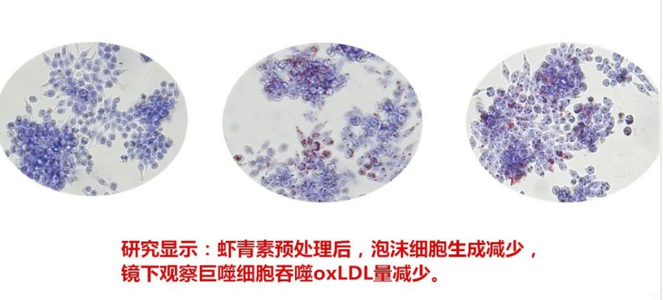 艾詩(shī)特蝦青素 艾詩(shī)特蝦青素